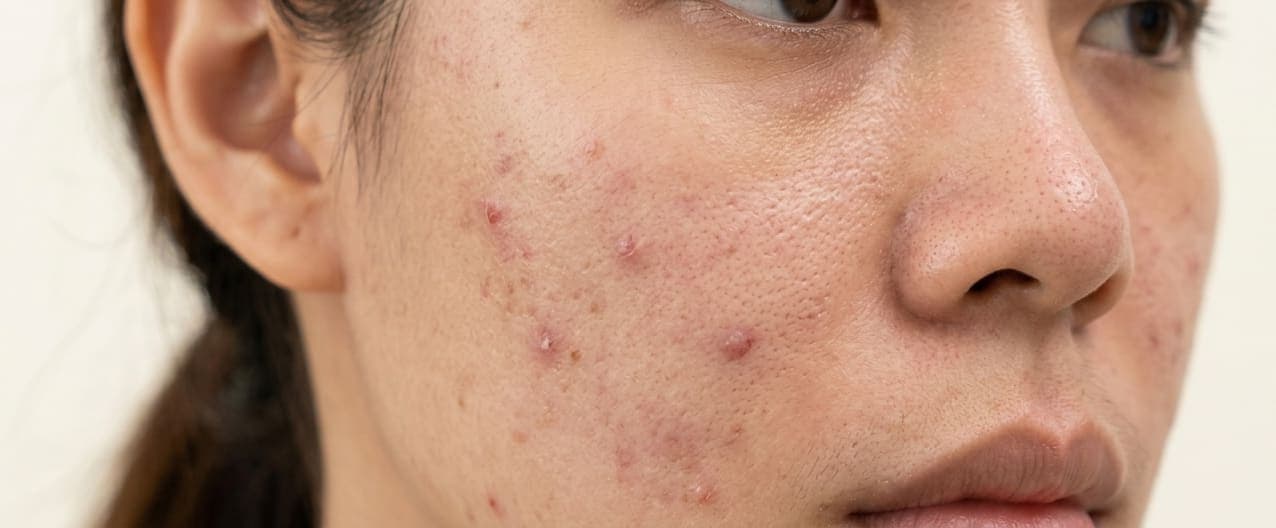 PHÂN LOẠI RÁC TẠI NGUỒN VÀ ĐỔI RÁC LẤY QUÀ - DUY TÂN CÙNG PHƯỜNG BÌNH TÂN